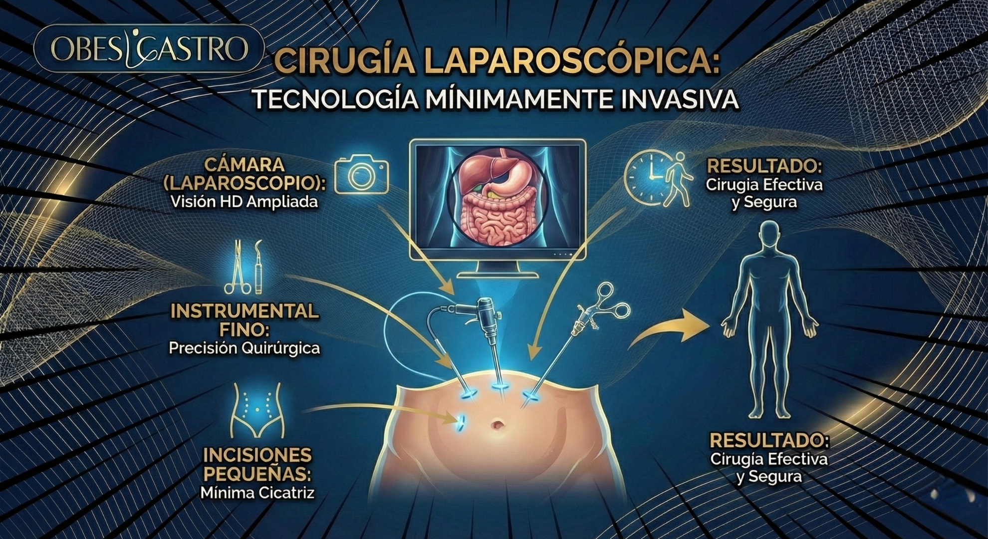 Cirugía Laparoscópica